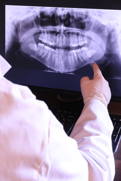 Best Emergency TMJ Treatment in Burlington, WI